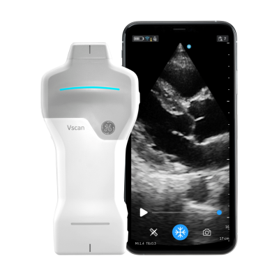 Wireless Handheld Ultrasound Device Launched by GE HealthCare for